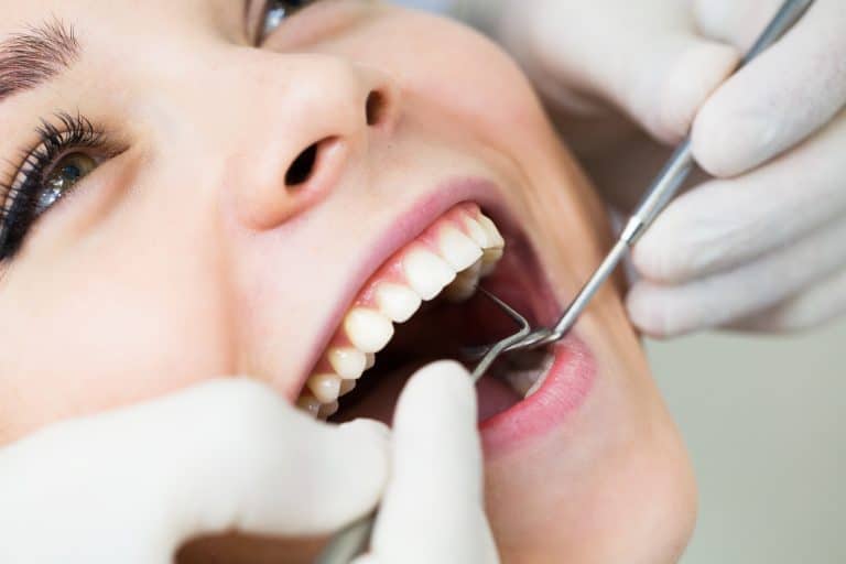 Everything You Need to Know About Dental Fillings